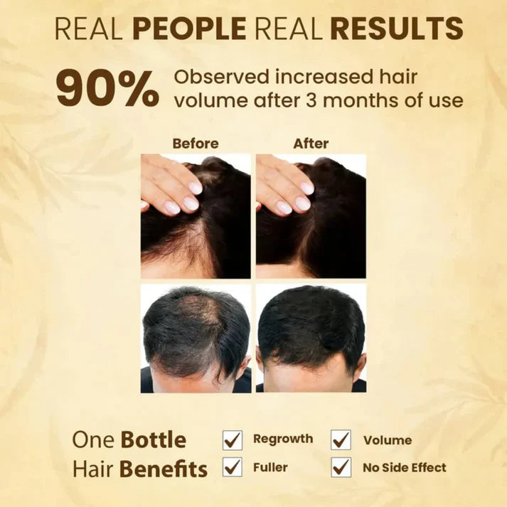 Jamalgota™ - Ayurvedic Hair Growth Powder 🌱