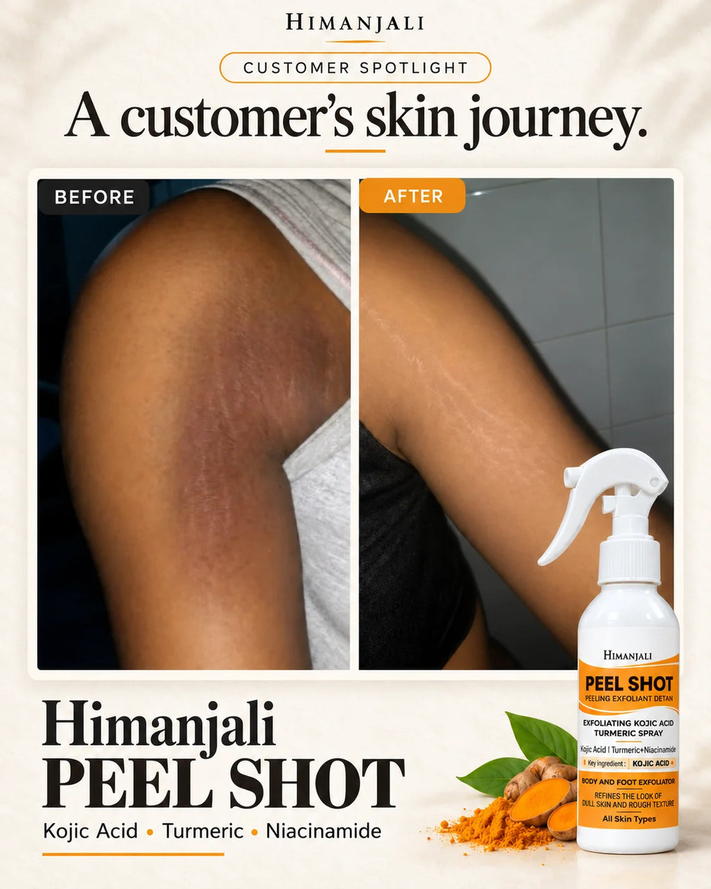Himanjali Peel Shot – Kojic Acid & Turmeric Body Exfoliating Spray