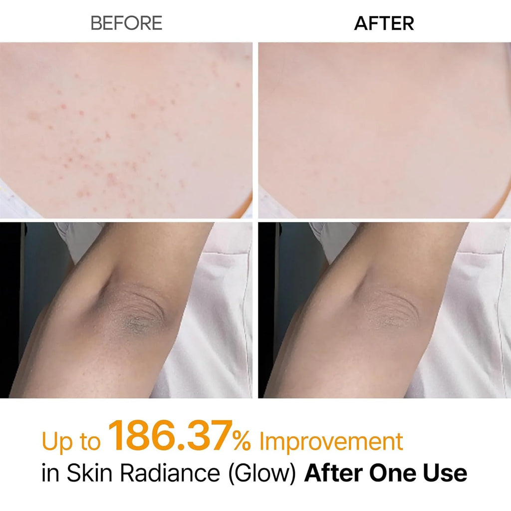 Himanjali Peel Shot – Kojic Acid & Turmeric Body Exfoliating Spray